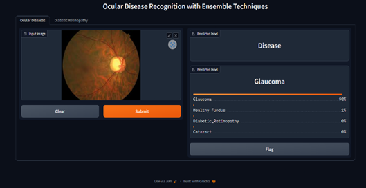 Ocular Disease Classification preview